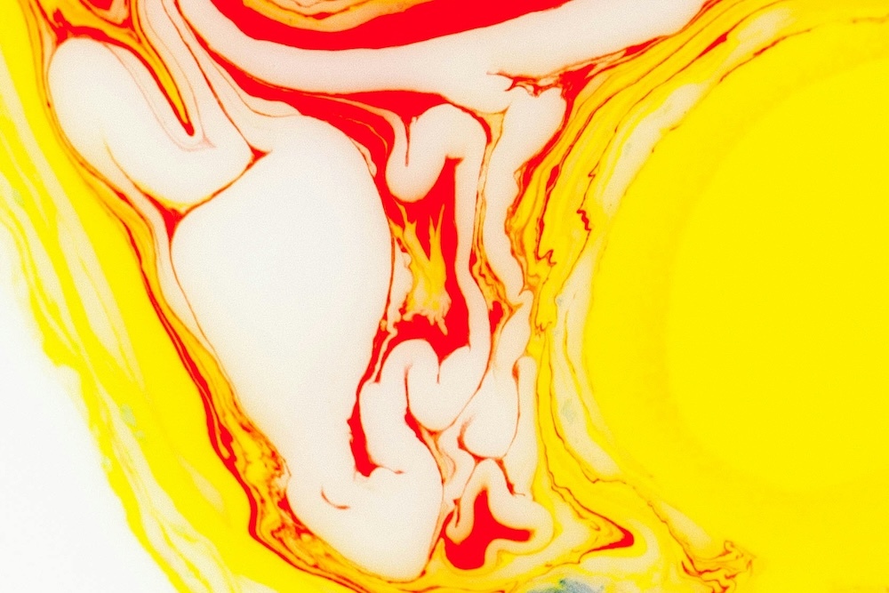 dr alexis granite morpheus8 treatment focus