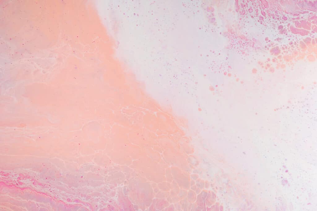 Perioral Dermatitis